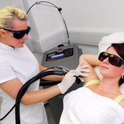 Laser hair removal, Cynosure, Lexinic.jpg