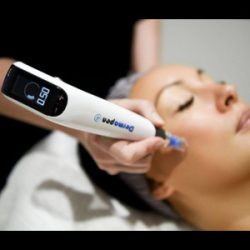 MicroNeedling, Lexinic Clinic.jpg